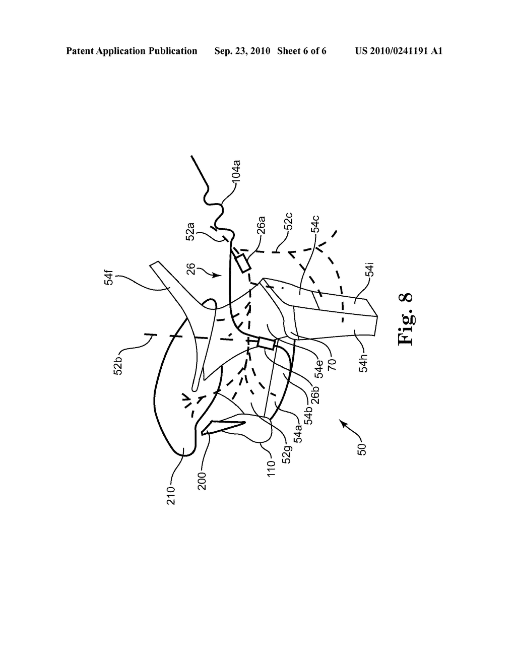 METHOD AND APPARATUS FOR ASSISTING DEGLUTITION - diagram, schematic, and image 07