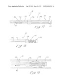 INDWELLING HEAT EXCHANGE CATHETER AND METHOD OF USING SAME diagram and image