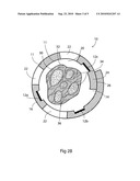 Implantable Medical Cuff with Electrode Array diagram and image