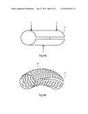 Implantable Medical Cuff with Electrode Array diagram and image