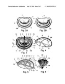 DEVICE FOR REPAIRING MITRAL VALVE INSUFFICIENCY diagram and image