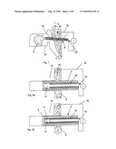 MEDICAL IMPLANT diagram and image