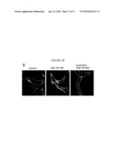 MODELS OF ATHEROSCLEROSIS, HYPERLIPIDEMIA, LIPOPROTEIN OXIDATION AND BLOOD VESSEL INFLAMMATION AND METHODS FOR MAKING AND USING THEM diagram and image