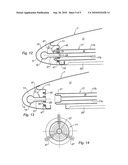 AIR INTAKE STRUCTURE TO BE MOUNTED UPSTREAM OF A NACELLE MIDDLE STRUCTURE FOR AIRCRAFT ENGINE, AND NACELLE EQUIPPED WITH SUCH AIR INTAKE STRUCTURE diagram and image