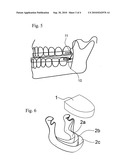 System for mandibular protrusion to prevent snoring and apnea diagram and image