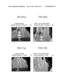 Operation Support System, Vehicle, And Method For Estimating Three-Dimensional Object Area diagram and image