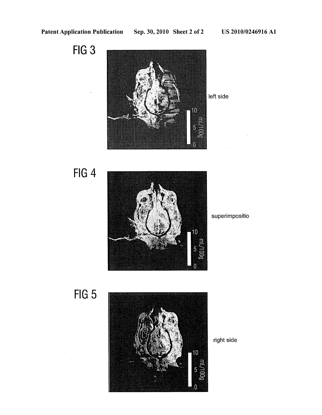 Method and apparatus for generating a functional data set of a perfused region of the human or animal body - diagram, schematic, and image 03