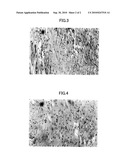  AGENT FOR REDUCING A SIDE EFFECT OF AN ANTICANCER DRUG diagram and image