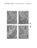 REPAIR AND TREATMENT OF BONE DEFECT USING CELLS INDUCED BY AGENT PRODUCED BY CHONDROCYTES CAPABLE OF HYPERTROPHICATION AND SCAFFOLD diagram and image