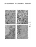 REPAIR AND TREATMENT OF BONE DEFECT USING CELLS INDUCED BY AGENT PRODUCED BY CHONDROCYTES CAPABLE OF HYPERTROPHICATION AND SCAFFOLD diagram and image