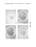 REPAIR AND TREATMENT OF BONE DEFECT USING CELLS INDUCED BY AGENT PRODUCED BY CHONDROCYTES CAPABLE OF HYPERTROPHICATION AND SCAFFOLD diagram and image