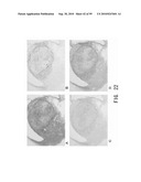 REPAIR AND TREATMENT OF BONE DEFECT USING CELLS INDUCED BY AGENT PRODUCED BY CHONDROCYTES CAPABLE OF HYPERTROPHICATION AND SCAFFOLD diagram and image