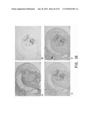 REPAIR AND TREATMENT OF BONE DEFECT USING CELLS INDUCED BY AGENT PRODUCED BY CHONDROCYTES CAPABLE OF HYPERTROPHICATION AND SCAFFOLD diagram and image