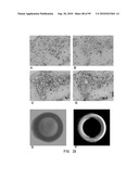 REPAIR AND TREATMENT OF BONE DEFECT USING CELLS INDUCED BY AGENT PRODUCED BY CHONDROCYTES CAPABLE OF HYPERTROPHICATION AND SCAFFOLD diagram and image