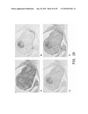 REPAIR AND TREATMENT OF BONE DEFECT USING CELLS INDUCED BY AGENT PRODUCED BY CHONDROCYTES CAPABLE OF HYPERTROPHICATION AND SCAFFOLD diagram and image