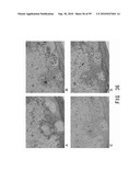 REPAIR AND TREATMENT OF BONE DEFECT USING CELLS INDUCED BY AGENT PRODUCED BY CHONDROCYTES CAPABLE OF HYPERTROPHICATION AND SCAFFOLD diagram and image