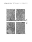 REPAIR AND TREATMENT OF BONE DEFECT USING CELLS INDUCED BY AGENT PRODUCED BY CHONDROCYTES CAPABLE OF HYPERTROPHICATION AND SCAFFOLD diagram and image