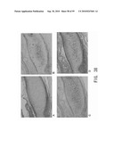 REPAIR AND TREATMENT OF BONE DEFECT USING CELLS INDUCED BY AGENT PRODUCED BY CHONDROCYTES CAPABLE OF HYPERTROPHICATION AND SCAFFOLD diagram and image