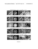 PEGYLATED COMPOUNDS FOR AGE-RELATED MACULAR DEGENERATION diagram and image