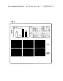 TELOMERASE REVERSE TRANSCRIPTASE VARIANT diagram and image