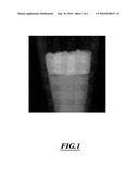 Galliated calcium phosphate biomaterials diagram and image