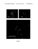 Method of Isolating Stem and Progenitor Cells From Placenta diagram and image