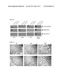 COMPOSITIONS AND METHODS FOR DIAGNOSIS AND TREATMENT OF CANCER diagram and image