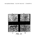 NELL Peptide Expression Systems and Bone Formation Activity of NELL Peptide diagram and image