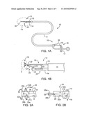 APPARATUS AND METHODS FOR ENDOSCOPIC SUTURING diagram and image