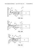 APPARATUS AND METHODS FOR ENDOSCOPIC SUTURING diagram and image