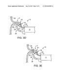 APPARATUS AND METHODS FOR ENDOSCOPIC SUTURING diagram and image