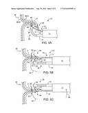 APPARATUS AND METHODS FOR ENDOSCOPIC SUTURING diagram and image