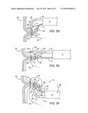 APPARATUS AND METHODS FOR ENDOSCOPIC SUTURING diagram and image