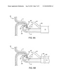 APPARATUS AND METHODS FOR ENDOSCOPIC SUTURING diagram and image