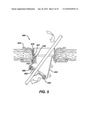 DEVICES AND METHODS FOR PROVIDING ACCESS INTO A BODY CAVITY diagram and image