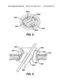 DEVICES AND METHODS FOR PROVIDING ACCESS INTO A BODY CAVITY diagram and image