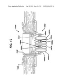 DEVICES AND METHODS FOR PROVIDING ACCESS INTO A BODY CAVITY diagram and image