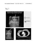 SYSTEM AND METHOD FOR AUTOMATIC TRIGGER-ROI DETECTION AND MONITORING DURING BOLUS TRACKING diagram and image