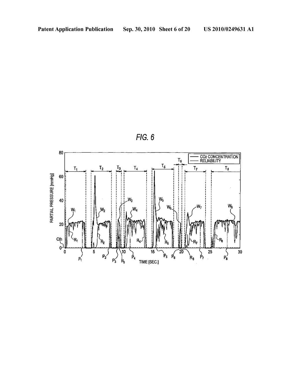 RESPIRATORY WAVEFORM ANALYZER - diagram, schematic, and image 07