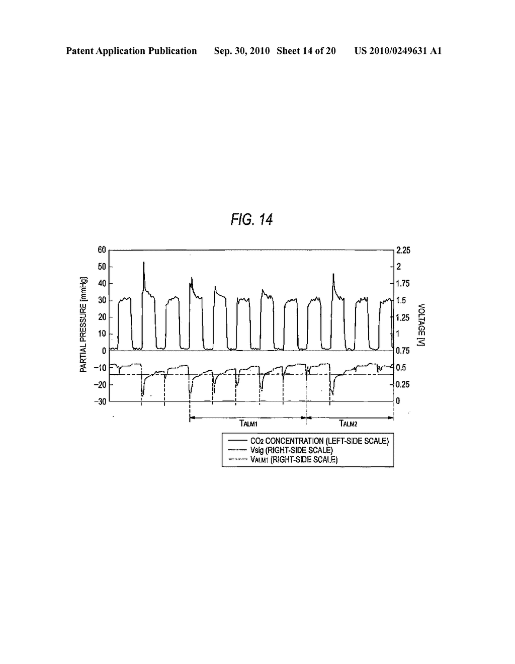 RESPIRATORY WAVEFORM ANALYZER - diagram, schematic, and image 15