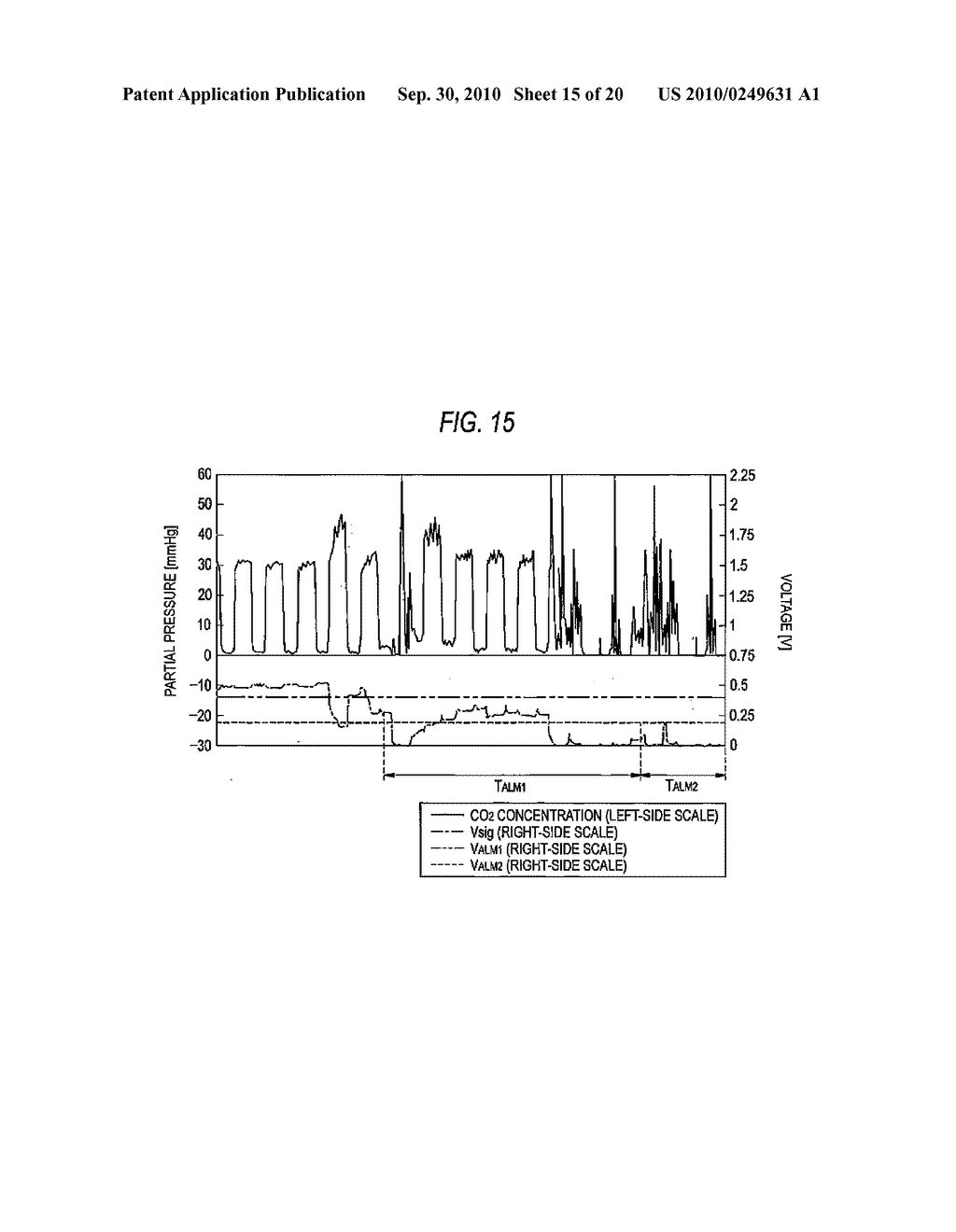 RESPIRATORY WAVEFORM ANALYZER - diagram, schematic, and image 16