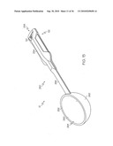 DEVICE AND METHOD FOR DETERMINING FORCE OF A KNEE JOINT diagram and image