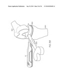 DEVICE AND METHOD FOR DETERMINING FORCE OF A KNEE JOINT diagram and image