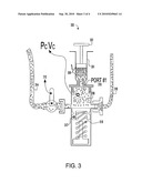 CONTINUOUS INTRA-ABDOMINAL PRESSURE MONITORING SYSTEM diagram and image