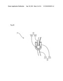 FINGER MOTION ASSISTING APPARATUS diagram and image