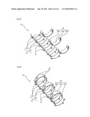 FINGER MOTION ASSISTING APPARATUS diagram and image