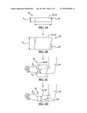 SHAPE MEMORY POLYMER MEDICAL CAST diagram and image