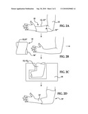 SHAPE MEMORY POLYMER MEDICAL CAST diagram and image