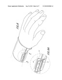 WRIST SUPPORT diagram and image