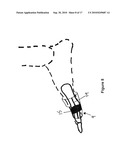 TOE BRACE DESIGNS diagram and image